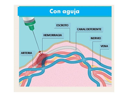 AGUJA